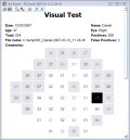 Checks the eye Visual Field for Glaucoma harm